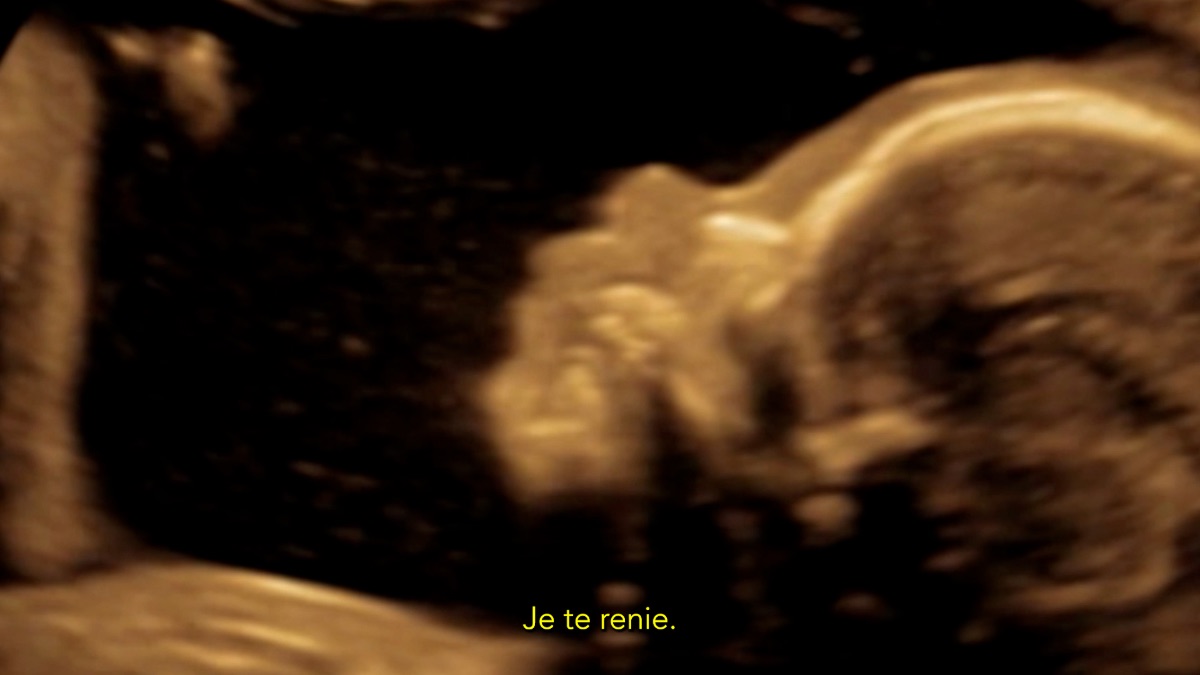 TRANCE THERAPY, LE FILM (don déductible de vos impôts) - photo 12